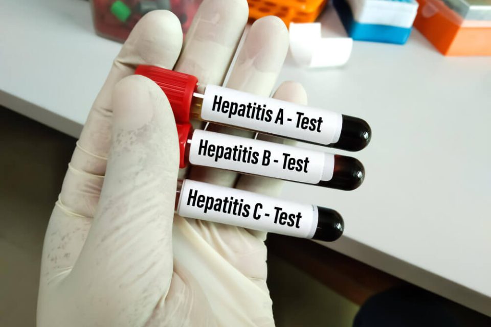 media-hepatit-c-xesteliyi